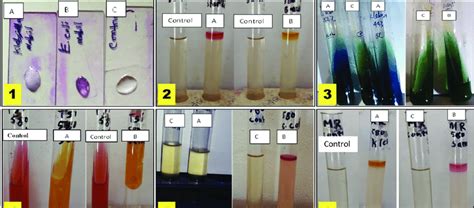klebsiella pneumoniae biochemical results.